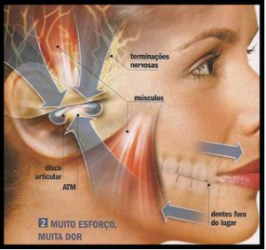 Dor orofacial (Problemas na A.T.M)