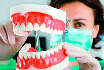 Implantes Dentários com carga imediata