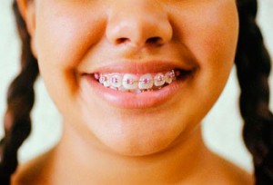 Malocluses - Siga Odontologia e Implantes Dentários