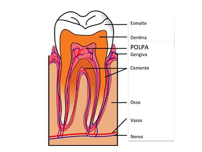 Esquema de um dente