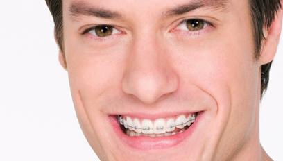 Por quanto tempo preciso usar meu aparelho dentário?