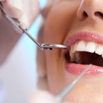 Dentição em dia com a manutenção dos implantes