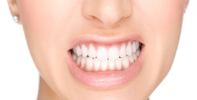 Como funciona o clareamento a laser?