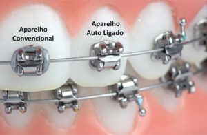 aparelhoautoligado 1