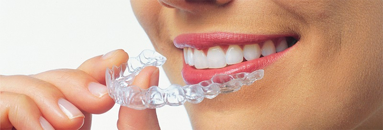 Aparelho de ortodontia Invisalign