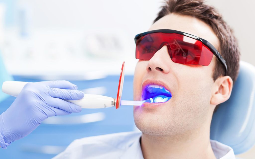 Procedimento do clareamento dentário