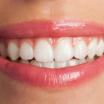 Como funciona o clareamento dental caseiro e quais os riscos?