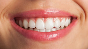 Como funciona o clareamento dental caseiro e quais os riscos?