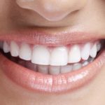 Em quais ocasiões são usados implantes dentários?