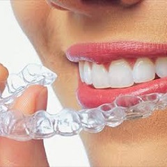 Aparelhos Invisalign