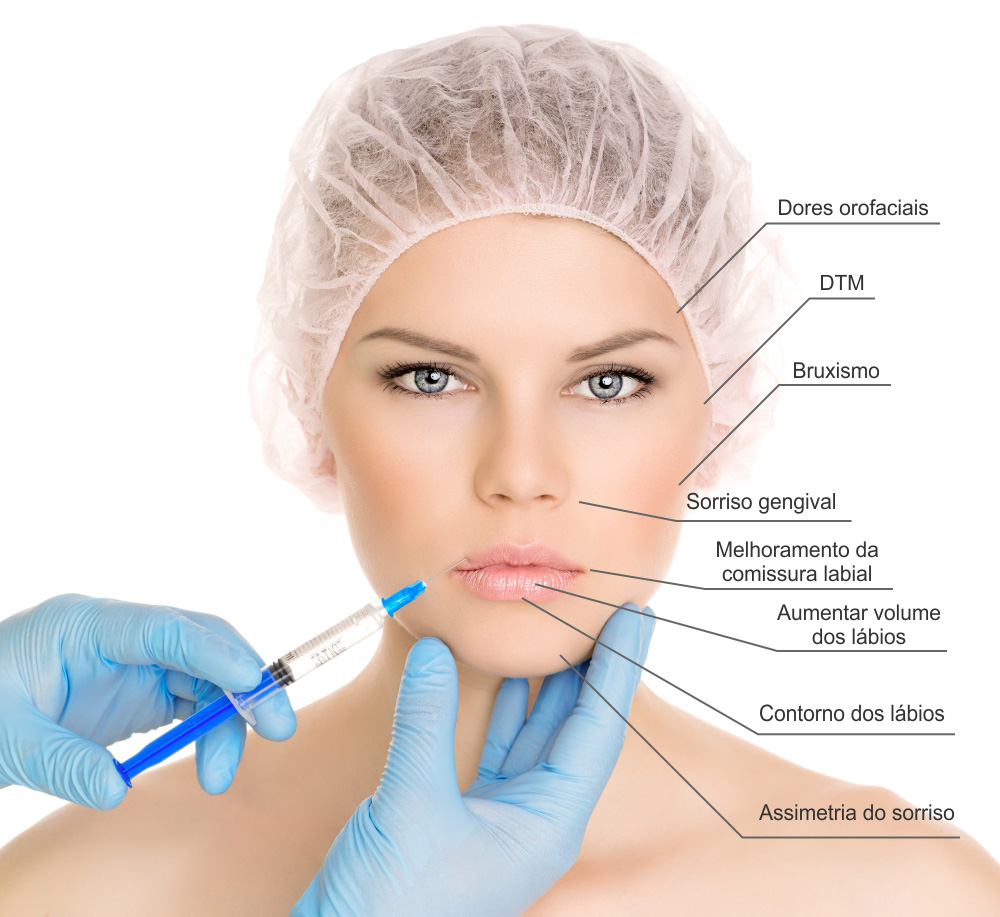 Botox - Tratamento Facial Brasília DF