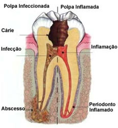 endodontia