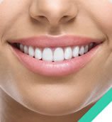 Clareamento Dental