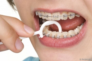 ortodontia limpeza