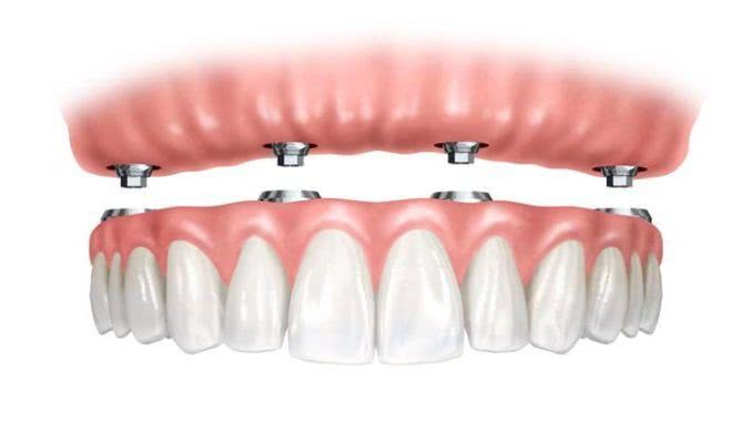 Protocolo dental
