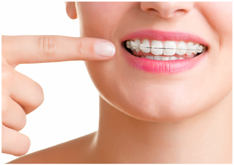 Aparelho Dentário
