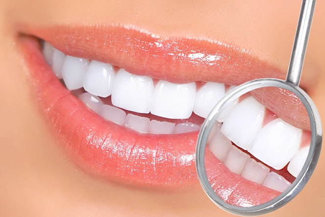 Clareamento Dental